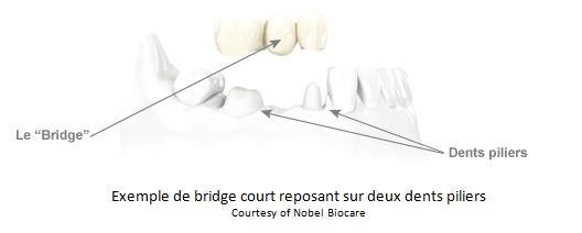 image-bridges