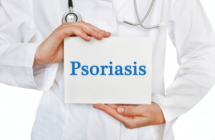 psoriasis