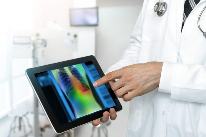Google lance un algorithme qui détecte le cancer du poumon !